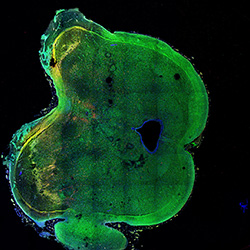 15PCW human midbrain